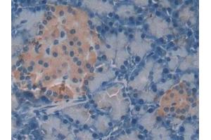 Immunohistochemistry (IHC) image for anti-Melanoma Associated Chondroitin Sulfate Proteoglycan (MCSP) (AA 1919-2258) antibody (ABIN7437680)