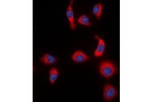 Immunofluorescence (IF) image for anti-Nuclear Factor of kappa Light Polypeptide Gene Enhancer in B-Cells Inhibitor, epsilon (NFKBIE) (pSer22) antibody (ABIN7303858)