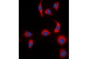Immunofluorescent analysis of IKB epsilon (pS22) staining in HeLa cells. (NFKBIE Antikörper  (pSer22))