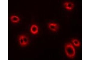 Immunofluorescent analysis of HLA-A staining in U2OS cells.