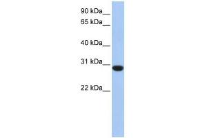 ASB12 antibody used at 1 ug/ml to detect target protein. (ASB12 Antikörper  (C-Term))