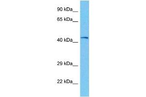 Host:  Mouse  Target Name:  PHKG2  Sample Tissue:  Mouse Kidney  Antibody Dilution:  1ug/ml (PHKG2 Antikörper  (N-Term))