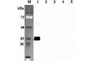 Western blot analysis using anti-Sirtuin 5 (human), pAb  at 1:2'000 dilution. (SIRT5 Antikörper)