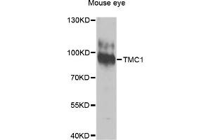 Western blot analysis of extracts of Mouse eye cells, using TMC1 antibody. (TMC1 Antikörper)