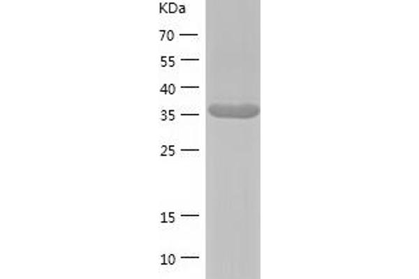 MAPK12 Protein (AA 1-367) (His tag)