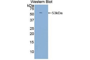 Western Blotting (WB) image for anti-Complement Component (3d/Epstein Barr Virus) Receptor 2 (CR2) (AA 729-957) antibody (ABIN1858487) (CD21 Antikörper  (AA 729-957))