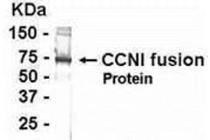 Western Blotting (WB) image for anti-Cyclin I (CCNI) (AA 211-377) antibody (ABIN2468095) (Cyclin I Antikörper  (AA 211-377))