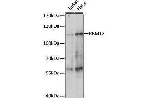 Western blot analysis of extracts of various cell lines, using RBM12 antibody (ABIN7270079) at 1:1000 dilution. (RBM12 Antikörper  (C-Term))