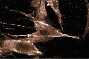 Immunofluorescence staining of WI-38 cells (Human lung fibroblasts, ATCC CCL-75). (BAD Antikörper  (AA 39-198))