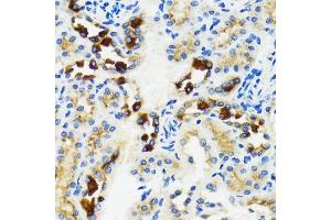 Immunohistochemistry (Paraffin-embedded Sections) (IHC (p)) image for anti-GABA(A) Receptor-Associated Protein (GABARAP) (AA 1-100) antibody (ABIN6140872)