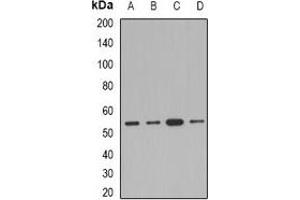 Western blot analysis of AEBP2 expression in Jurkat (A), A549 (B), mouse kidney (C), rat heart (D) whole cell lysates. (AEBP2 Antikörper)