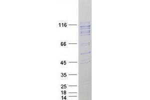 Western Blotting (WB) image for Inter alpha Globulin Inhibitor H4 (ITIH4) protein (Myc-DYKDDDDK Tag) (ABIN2723904)