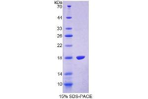 SDS-PAGE analysis of Human TRPV3 Protein. (TRPV3 Protein)