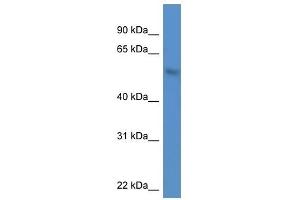 Western Blot showing MKNK1 antibody used at a concentration of 1. (MKNK1 Antikörper  (N-Term))