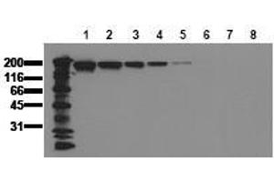 Western Blotting (WB) image for anti-Epidermal Growth Factor Receptor (EGFR) (AA 960-980) antibody (ABIN126763) (EGFR Antikörper  (AA 960-980))