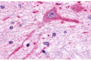 Image no. 1 for anti-Melanin-Concentrating Hormone Receptor 2 (MCHR2) (C-Term) antibody (ABIN1049056) (MCHR2 Antikörper  (C-Term))