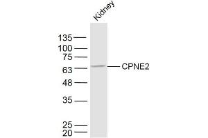 Mouse kidney lysates probed with CPNE2 Polyclonal Antibody, Unconjugated  at 1:300 dilution and 4˚C overnight incubation. (Copine II Antikörper  (AA 81-180))