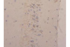 Detection of NGAL in Rat Brain Tissue using Polyclonal Antibody to Neutrophil gelatinase-associated lipocalin (NGAL) (Lipocalin 2 Antikörper  (AA 21-198))