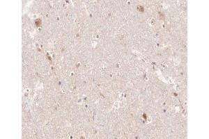 Immunohistochemistry (IHC) image for anti-Prostaglandin-Endoperoxide Synthase 1 (Prostaglandin G/H Synthase and Cyclooxygenase) (PTGS1) (C-Term) antibody (ABIN6260980)