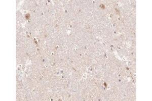 ABIN6266518 at 1/200 staining human brain tissue sections by IHC-P. (PTGS1 Antikörper  (C-Term))