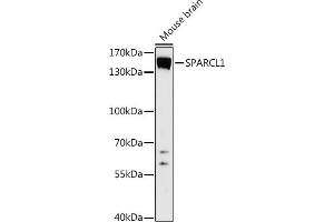 Western blot analysis of extracts of Mouse brain, using SP antibody (ABIN7270512) at 1:1000 dilution. (SPARCL1 Antikörper  (AA 17-300))