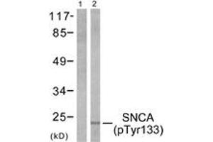 Western blot analysis of extracts from 293 cells treated with Etoposide 25 muM 60', using Synuclein-alpha (Phospho-Tyr133) Antibody. (SNCA Antikörper  (pTyr133))