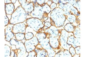 Formalin-fixed, paraffin-embedded human Placenta stained with Insulin Receptor Rabbit Recombinant Monoclonal Antibody (INSR/2277R). (Rekombinanter Insulin Receptor Antikörper  (Extracellular Domain))
