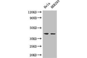 Western Blot Positive WB detected in: Hela whole cell lysate, HEK293 whole cell lysate All lanes: ACTG1 antibody at 3 μg/mL Secondary Goat polyclonal to rabbit IgG at 1/50000 dilution Predicted band size: 42 kDa Observed band size: 42 kDa (Actin, gamma 1 Antikörper  (AA 13-166))