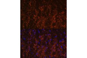Immunofluorescence analysis of mouse brain using SNX13 antibody (ABIN6129554, ABIN6148236, ABIN6148237 and ABIN6216585) at dilution of 1:100. (SNX13 Antikörper  (AA 50-230))