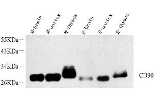 Western Blot analysis of various samples using THY1 Polyclonal Antibody at dilution of 1:1000. (CD90 Antikörper)