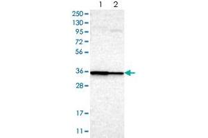 Western blot analysis of Lane 1: RT-4, Lane 2: U-251MG sp with LAX1 polyclonal antibody  at 1:100-1:250 dilution. (LAX1 Antikörper)