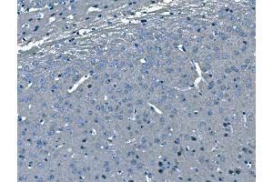 IHC analysis of B Raf/BRAF using anti-B Raf/BRAF antibody (ABIN3043761). (BRAF Antikörper  (AA 38-230))