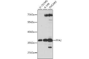 Western blot analysis of extracts of various cell lines, using PP antibody (ABIN7269763) at 1:1000 dilution.