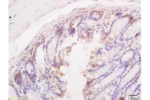 Formalin-fixed and paraffin embedded mouse intestine tissue labeled with Anti BIM/BCL2L11 Polyclonal Antibody, Unconjugated (ABIN687277) at 1:200 followed by conjugation to the secondary antibody and DAB staining (BIM Antikörper  (AA 51-150))