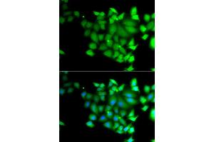 Immunofluorescence analysis of A549 cell using TET3 antibody. (TET3 Antikörper)