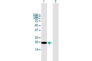 Western Blot analysis of MRPL49 expression in transfected 293T cell line by MRPL49 MaxPab polyclonal antibody. (MRPL49 Antikörper  (AA 1-166))