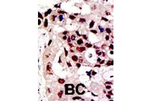 Immunohistochemistry (IHC) image for anti-Protein Inhibitor of Activated STAT, 3 (PIAS3) antibody (ABIN2996753) (PIAS3 Antikörper)