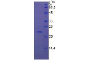 SDS-PAGE analysis of Cow RBP4 Protein.