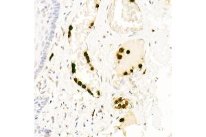 Immunohistochemistry of paraffin-embedded human esophagus using Neutrophil Elastase (ELANE) Rabbit pAb (ABIN6131604, ABIN6140110, ABIN6140111 and ABIN6216843) at dilution of 1:25 (40x lens). (ELANE Antikörper  (AA 30-267))
