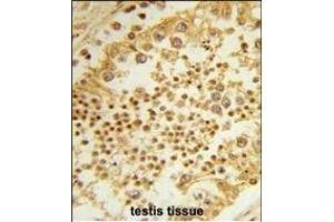 Formalin-fixed and paraffin-embedded human testis tissue reacted with RPL31 Antibody (Center), which was peroxidase-conjugated to the secondary antibody, followed by DAB staining. (RPL31 Antikörper  (AA 24-51))