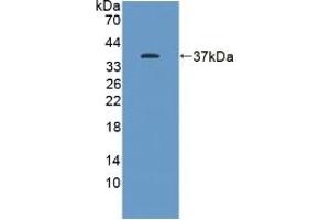 Detection of Recombinant KEAP1, Human using Polyclonal Antibody to Kelch Like ECH Associated Protein 1 (KEAP1) (KEAP1 Antikörper  (AA 327-624))