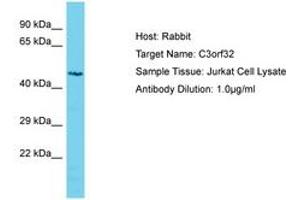Image no. 1 for anti-Ssu-2 Homolog (C. Elegans) (SSUH2) (AA 184-233) antibody (ABIN6750606)