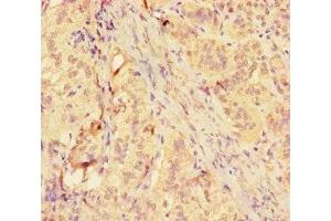 Immunohistochemistry of paraffin-embedded human adrenal gland tissue using ABIN7158878 at dilution of 1:100 (MMP12 Antikörper  (AA 109-470))