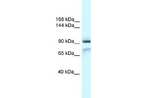 WB Suggested Anti-Gria1 Antibody Titration: 1. (Glutamate Receptor 1 Antikörper  (N-Term))