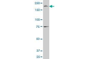 FMN2 polyclonal antibody (A01), Lot # 060726QCS1 Western Blot analysis of FMN2 expression in K-562 . (Formin 2 Antikörper  (AA 144-243))