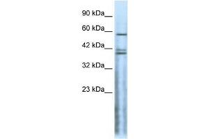 Western Blot showing CHRND antibody used at a concentration of 1-2 ug/ml to detect its target protein. (CHRND Antikörper  (N-Term))