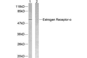 Western blot analysis of extracts from MCF7 cells using Estrogen Receptor-α (Ab-118) antibody (E021067). (Estrogen Receptor alpha Antikörper)