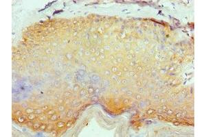 Immunohistochemistry of paraffin-embedded human skin tissue using ABIN7158251 at dilution of 1:100