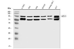 Western blot analysis of BBS9 using anti-BBS9 antibody (ABIN7601518). (BBS9 Antikörper  (AA 37-793))