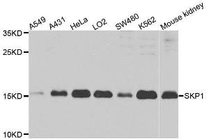 Western blot analysis of extracts of various cell lines, using SKP1 antibody. (SKP1 Antikörper  (AA 1-163))